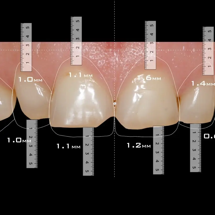 Dentysta Lwów - dental wakacje