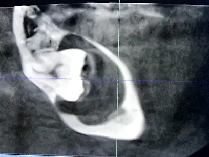 Стоматология ,,Зуб Мудрости,,