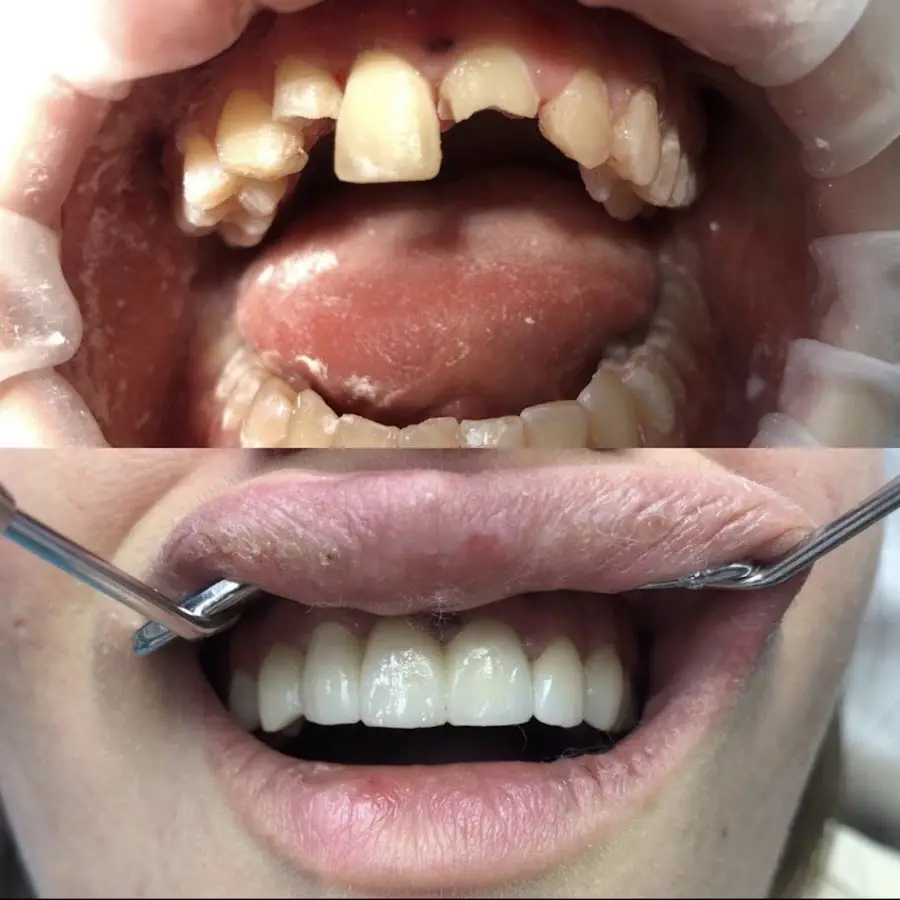 Ваш Стоматолог, имплантация зубов , лечение , протезирование