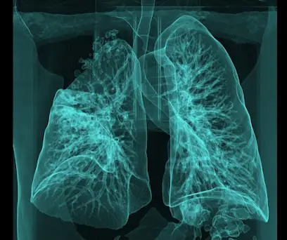 Кабінет комп&lsquo;ютерної томографії &laquo;Медікал Сервіс Груп&raquo;