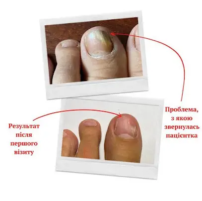 Центр подологии, маникюра, педикюра Сан-Тропе