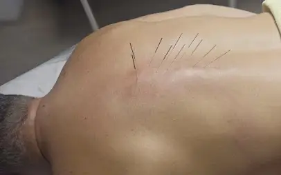 Лікувальний масаж